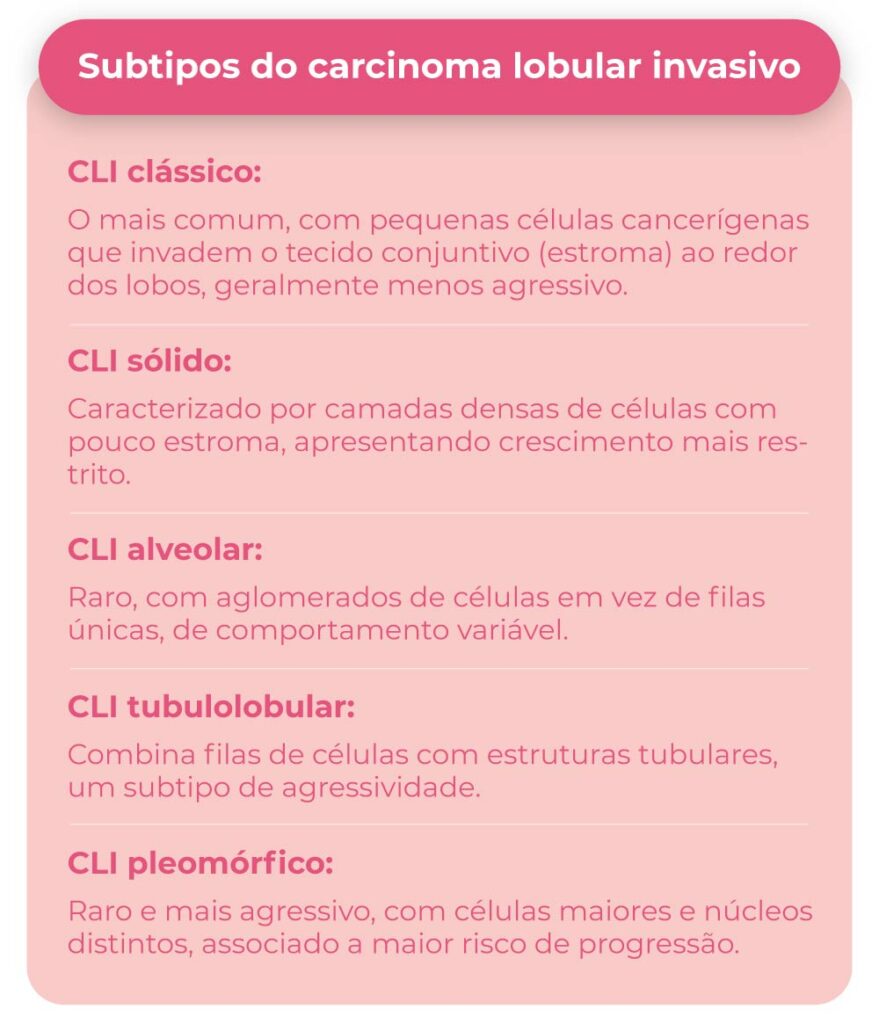 Subtipos do carcinoma lobular invasivo
CLI clássico: o mais comum, com pequenas células cancerígenas que invadem o tecido conjuntivo (estroma) ao redor dos lobos, geralmente menos agressivo.
CLI sólido: caracterizado por camadas densas de células com pouco estroma, apresentando crescimento mais restrito.
CLI alveolar: raro, com aglomerados de células em vez de filas únicas, de comportamento variável.
CLI túbulo lobular: combina filas de células com estruturas tubulares, um subtipo de agressividade.
CLI pleomórfico: raro e mais agressivo, com células maiores e núcleos distintos, associado a maior risco de progressão.