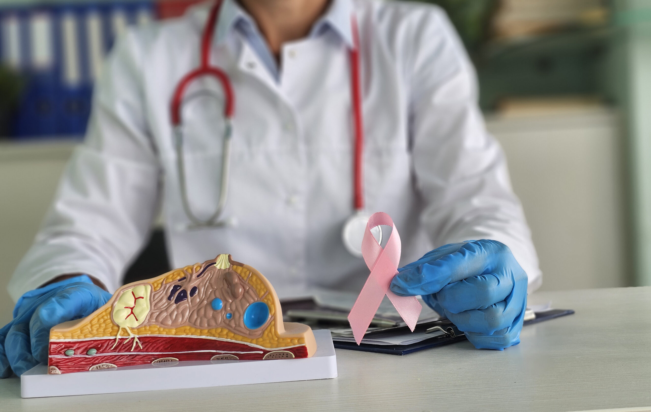 Médica segurando laço rosa ao lado de modelo anatômico da mama. Conceito de apoio no câncer de mama e biópsia linfonodal.