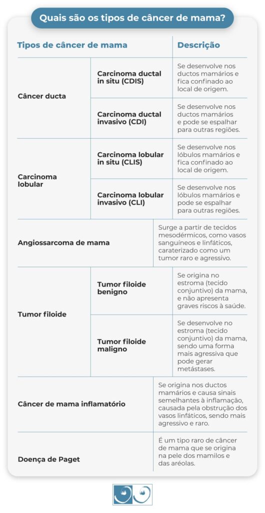 Quais são os tipos de câncer de mama?
Tipos de câncer de mama
Descrição
Câncer ductal
Carcinoma ductal in situ (CDIS)
Se desenvolve nos ductos mamários e fica confinado ao local de origem
Carcinoma ductal invasivo (CDI)
Se desenvolve nos ductos mamários e pode se espalhar para outras regiões
Carcinoma lobular
Carcinoma lobular in situ (CLIS)
Se desenvolve nos lóbulos mamários e fica confinado ao local de origem.
Carcinoma lobular invasivo (CLI)
Se desenvolve nos lóbulos mamários e pode se espalhar para outras regiões.
Angiossarcoma de mama
Surge a partir de tecidos mesodérmicos, como vasos sanguíneos e linfáticos, caraterizado como um tumor raro e agressivo.
Tumor filoide
Tumor filoide benigno
Se origina no estroma (tecido conjuntivo) da mama, e não apresenta graves riscos à saúde.
Tumor filoide maligno
Se desenvolve no estroma (tecido conjuntivo) da mama, sendo uma forma mais agressiva que pode gerar metástases.
Câncer de mama inflamatório
Se origina nos ductos mamários e causa sinais semelhantes à inflamação, causada pela obstrução dos vasos linfáticos, sendo mais agressivo e raro.
Doença de Paget
É um tipo raro de câncer de mama que se origina na pele dos mamilos e das aréolas.

