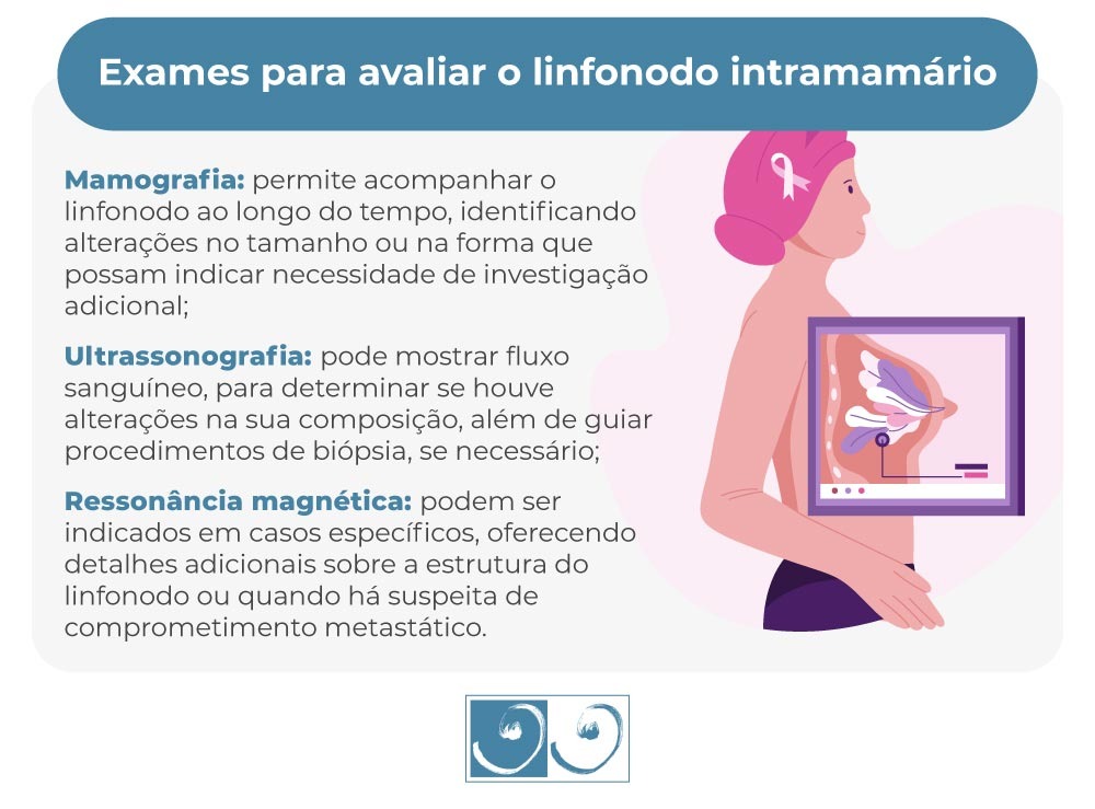 Exames para avaliar o linfonodo intramamário
Mamografia: permite acompanhar o linfonodo ao longo do tempo, identificando alterações no tamanho ou na forma que possam indicar necessidade de investigação adicional;
Ultrassonografia: pode mostrar fluxo sanguíneo, para determinar se houve alterações na sua composição, além de guiar procedimentos de biópsia, se necessário; 
Ressonância magnética: podem ser indicados em casos específicos, oferecendo detalhes adicionais sobre a estrutura do linfonodo ou quando há suspeita de comprometimento metastático.