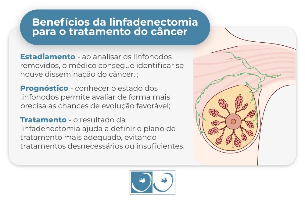 Benefícios da linfadenectomia para o tratamento do câncer