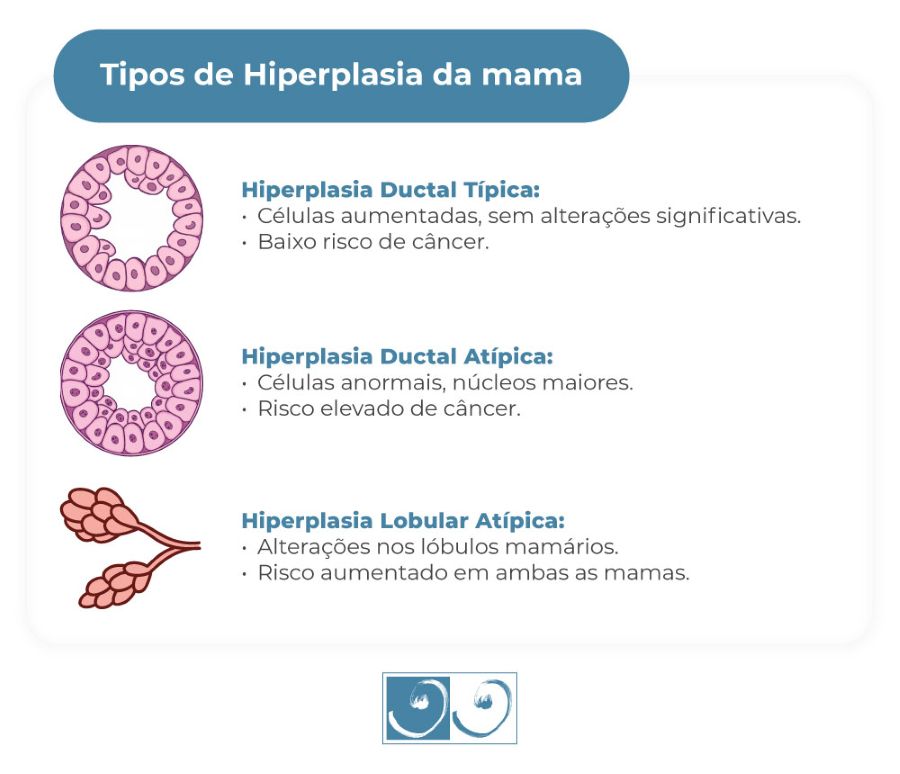 Tipos de hiperplasia da mama