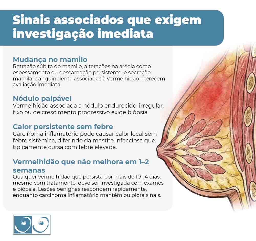 Infográfico mostra sinais na mama que exigem investigação imediata, como retração do mamilo, nódulo palpável e vermelhidão persistente.